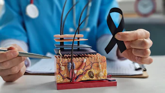 Healthcare professional holding black awareness ribbon beside anatomical skin tissue model in clinical setting